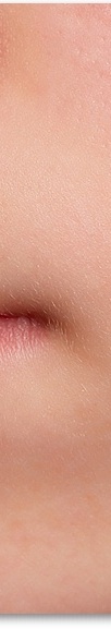 신논현역피부과 여드름 치료 흉터 관리를 위한 피부과전문의가 알려주는 방법 관련 이미지 17