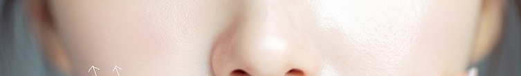 초음파 리프팅 효과, 사람마다 유지기간이 다른 이유 관련 이미지 37