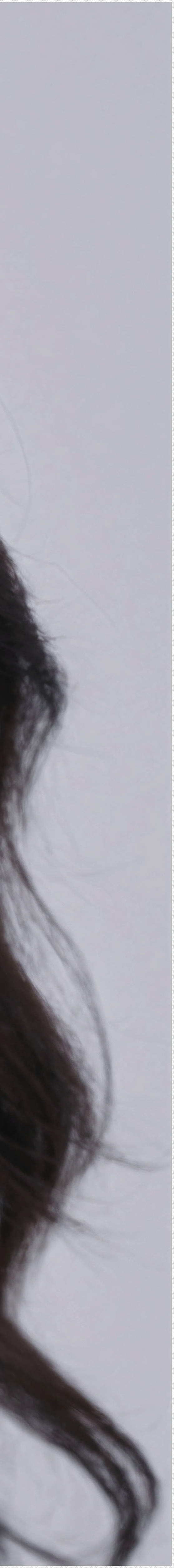 There Are Specific Criteria for Personally Evaluating Where to Get Good Thermage in Gangnam image 33