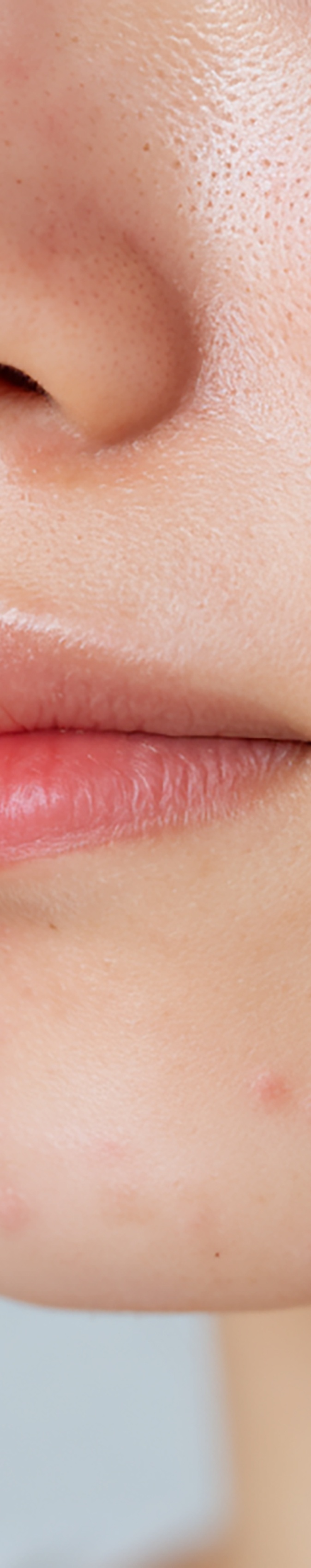 강남역여드름피부과 자국을 없애고 싶다면 관련 이미지 17