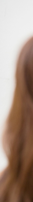 Treatment for Closed Comedones by a Dermatologist in Gangnam image 37