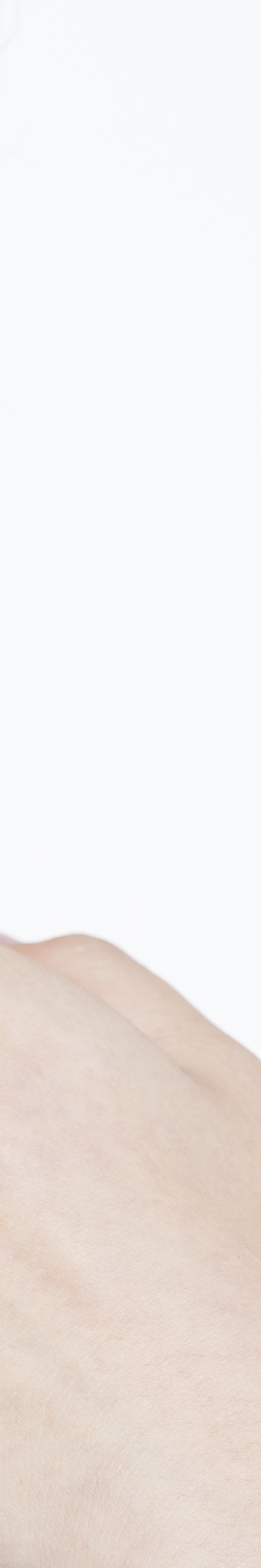 서초동리프팅 이건 어떤 효과가 있을까요 관련 이미지 29