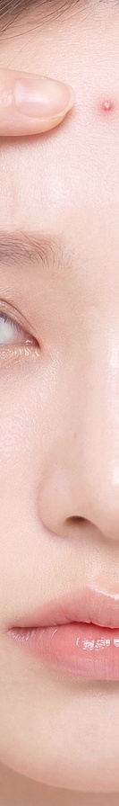 Clearing Acne Scar Marks with Laser Treatment in Nonhyeon image 41