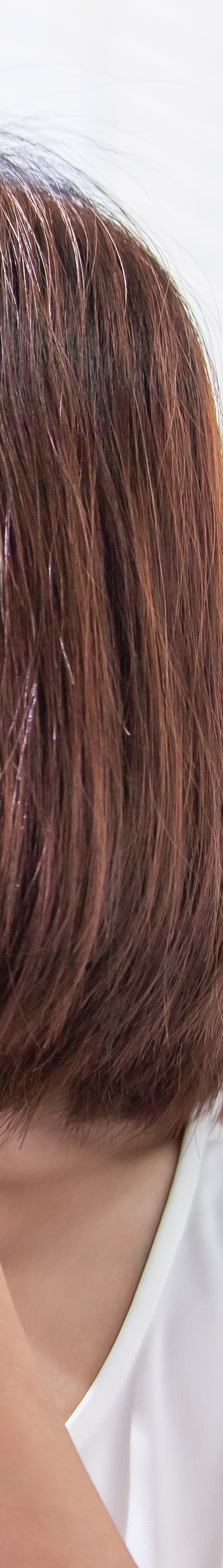 서초동여드름치료 뭐가 제일 중요할까 관련 이미지 20