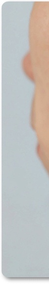 신논현역피부과 여드름 치료 흉터 관리를 위한 피부과전문의가 알려주는 방법 관련 이미지 33
