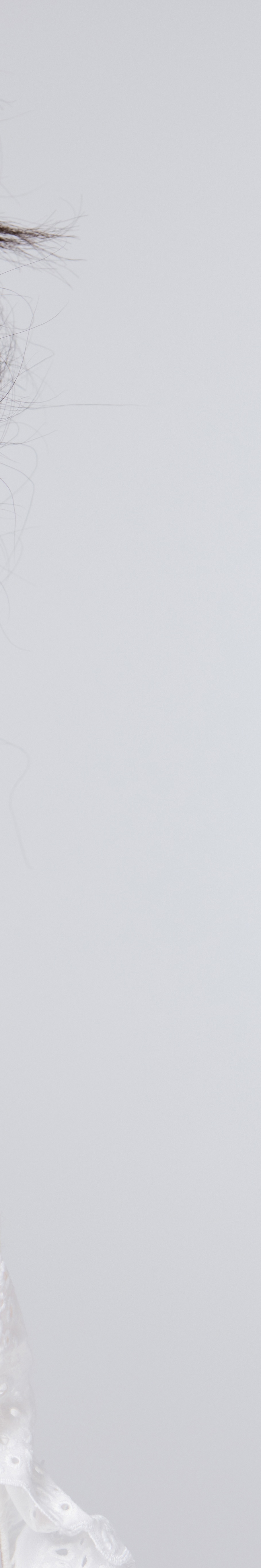 서초동여드름치료 뭐가 제일 중요할까 관련 이미지 29