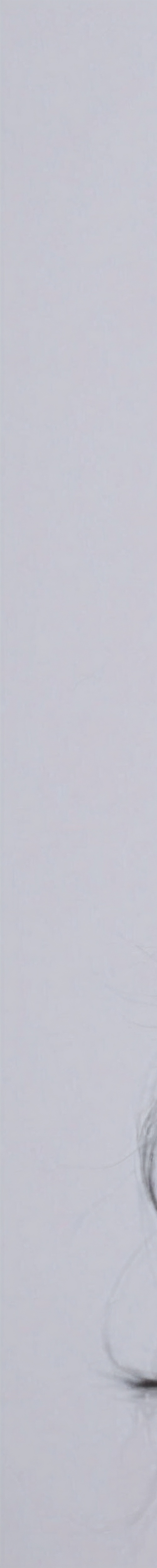 서초리프팅잘하는곳 한 번에 파악할 수 있다면 관련 이미지 14