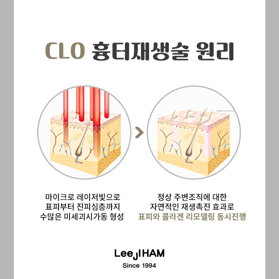 서초동여드름흉터 아프지 않게 관리하고자 관련 이미지 6