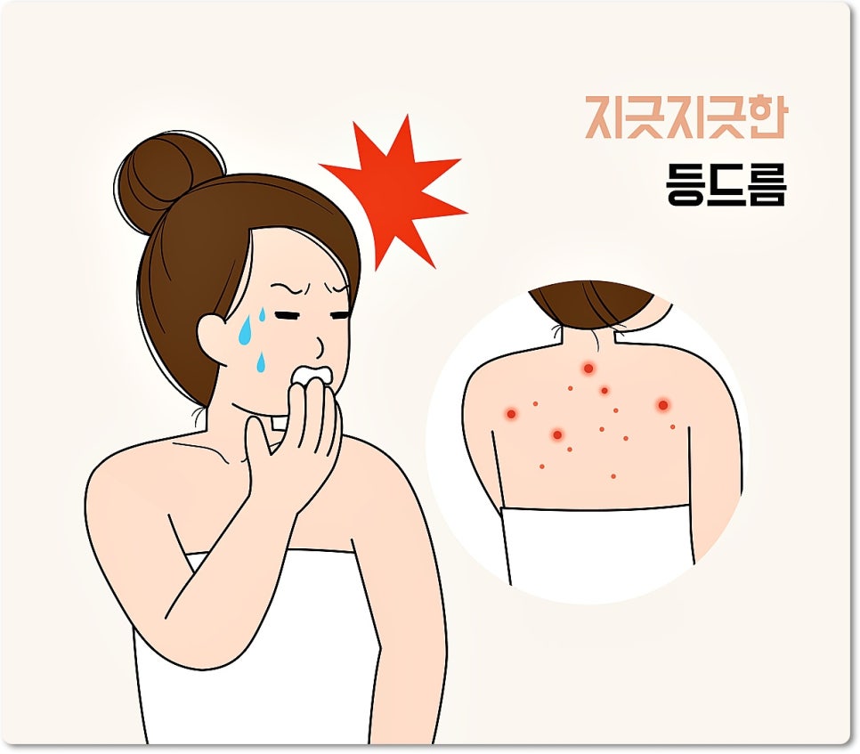 강남 등여드름치료, 원인을 알아야 케어가 시작됩니다 관련 이미지 3