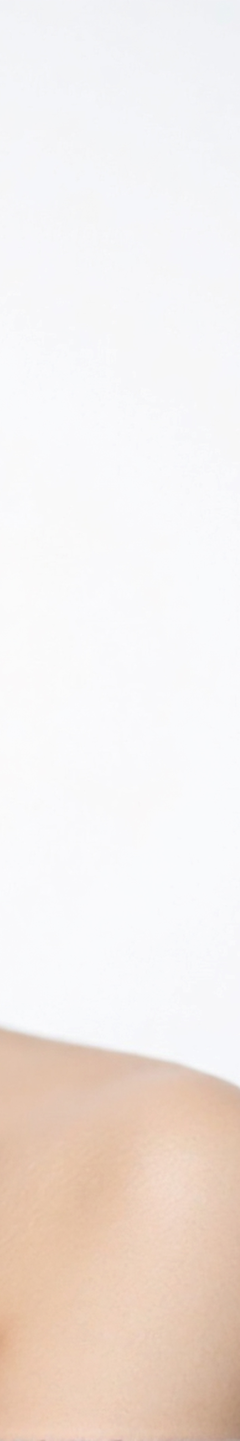 강남역여드름흉터 과연 효과가 있을까요 관련 이미지 23