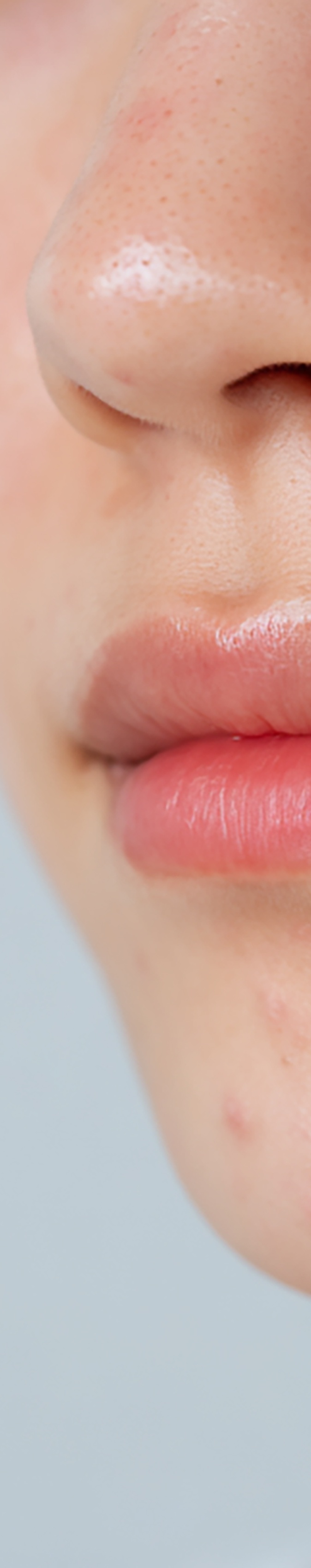 강남역여드름피부과 자국을 없애고 싶다면 관련 이미지 16