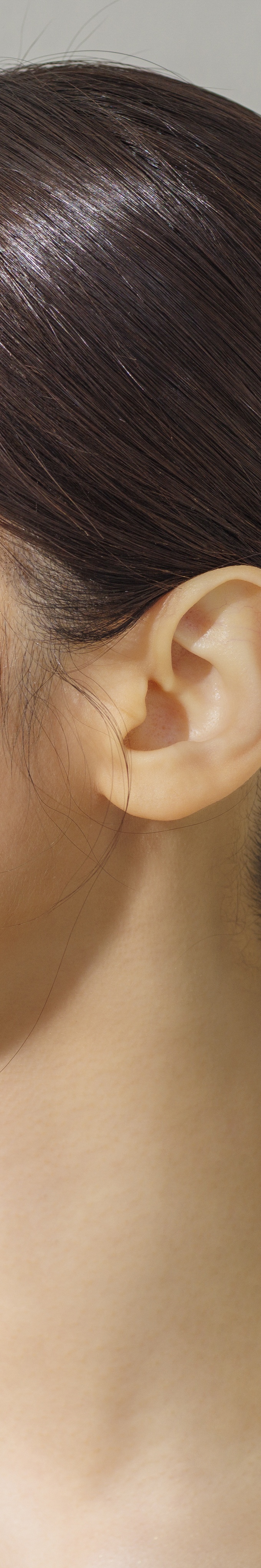 서초구 피부과 추천 여드름자국 때문에 고민된다면 관련 이미지 28