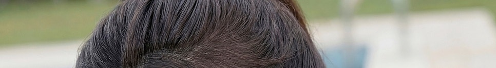 신논현역 피부과 써마지 리프팅에 대해 관련 이미지 25