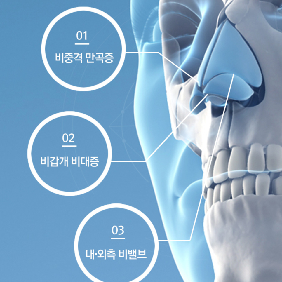 [Cocoline Clinic] For rhinitis and nose surgery, what kind of medical team should you choose? image 1