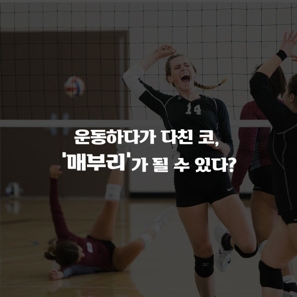 코코라인의원 칼럼, 예전에 다친 코 매부리가 될 수 있다? 관련 이미지 1