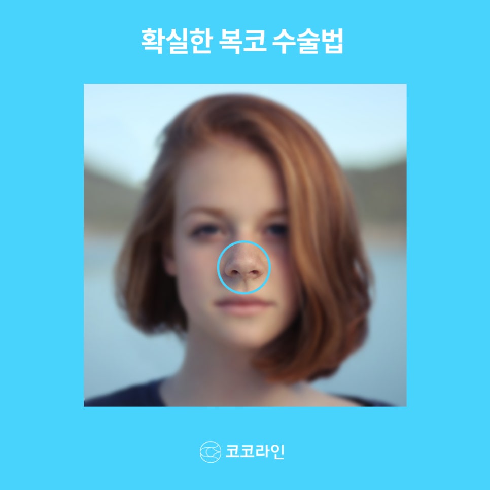복코 수술 답을 찾고 싶다면 들어오세요. 관련 이미지 1
