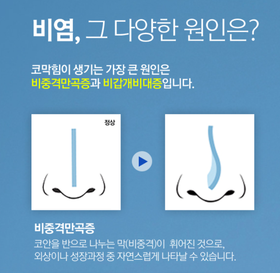 [Cocoline Clinic] Treat Nasal Conditions and Nose Surgery at the Same Time image 2