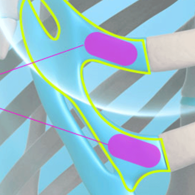 If You're Curious About Autologous Rib Cartilage, Click Here! image 8
