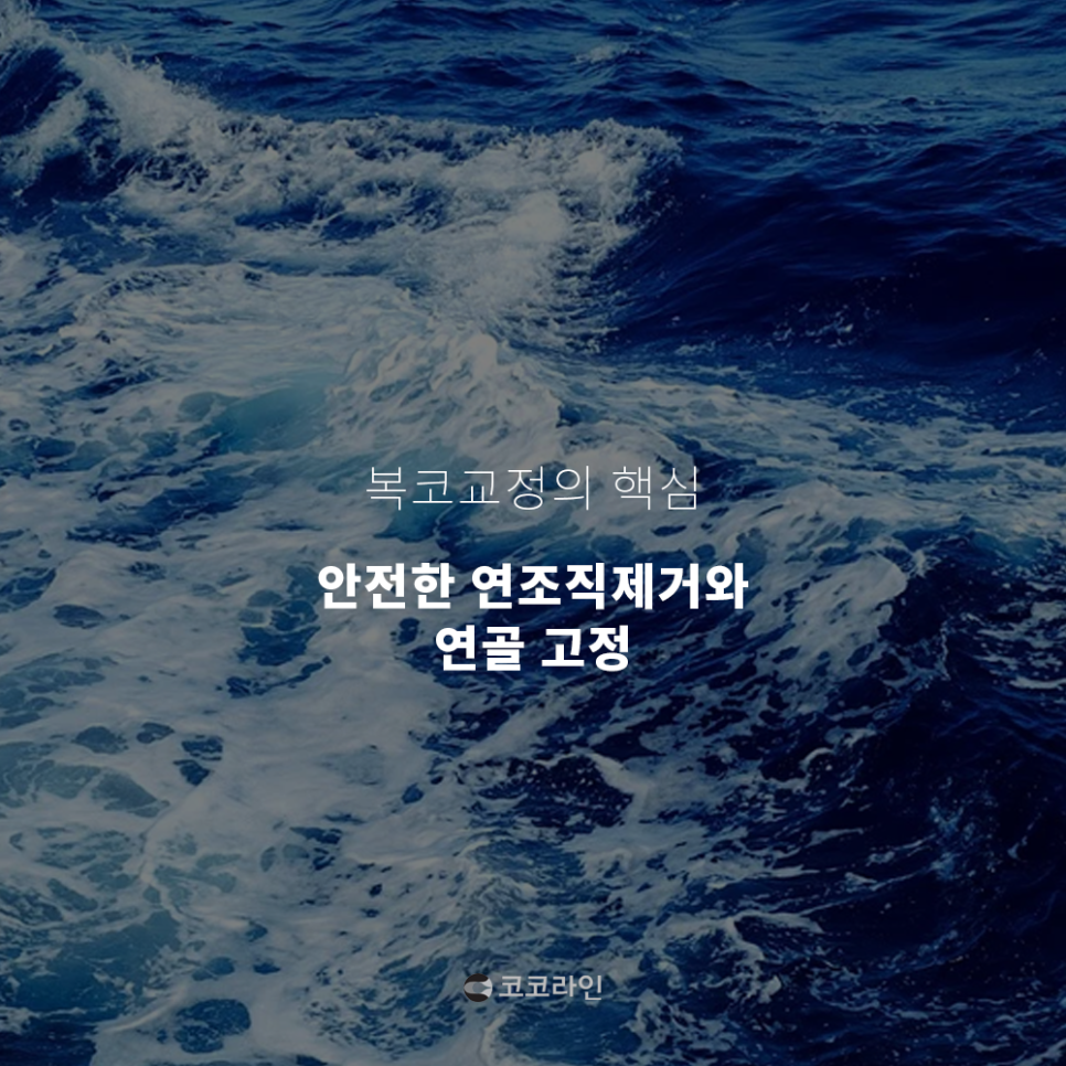 복코 교정? 여기서 가능해요. 관련 이미지 2