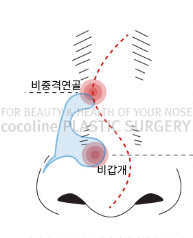 What Causes Nasal Congestion During Seasonal Changes? image 1