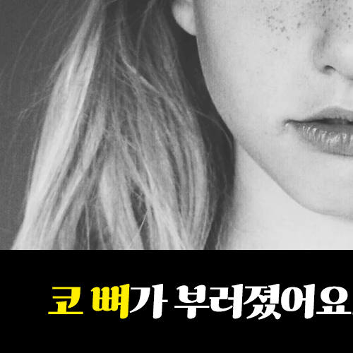 코뼈 (비골) 골절 수술 보험에 대하여 관련 이미지 3