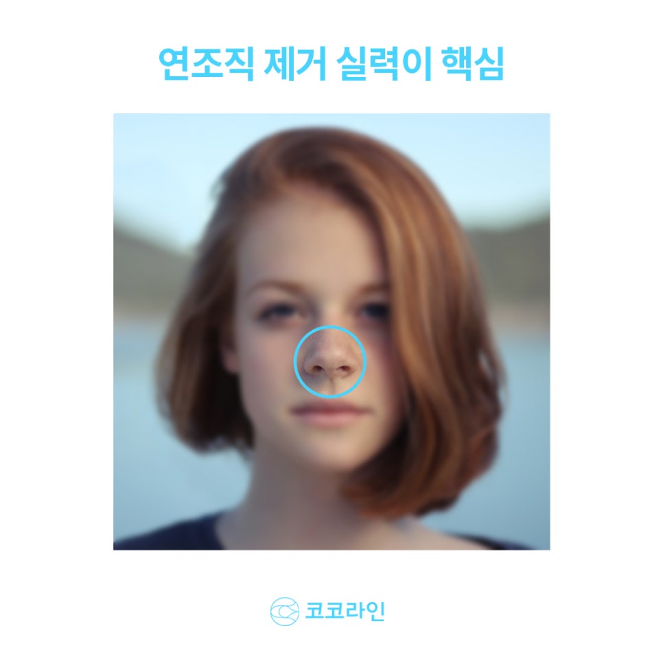 복코 수술 답을 찾고 싶다면 들어오세요. 관련 이미지 2