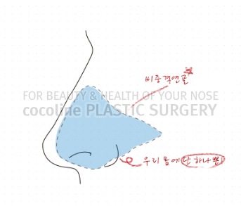 What Causes Nasal Congestion During Seasonal Changes? image 2