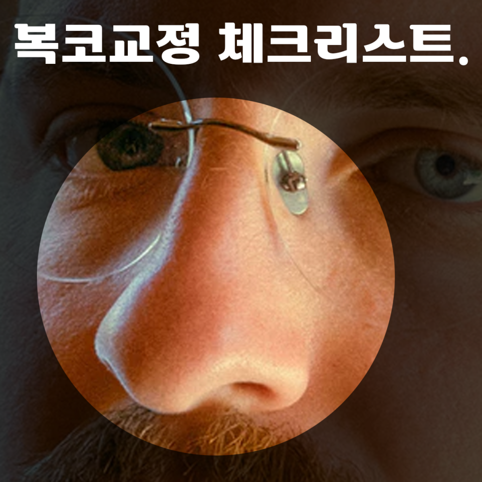 코코라인의원 복코 교정은 어떻게? 관련 이미지 1