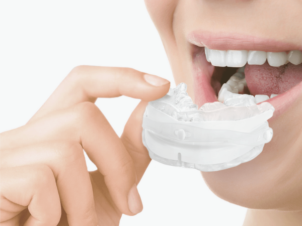 마곡동치과_ "불편함은 잠시, 꿀잠은 오래!" [ 2. 코골이 장치 사용 후기와 적응법 ] 관련 이미지 3