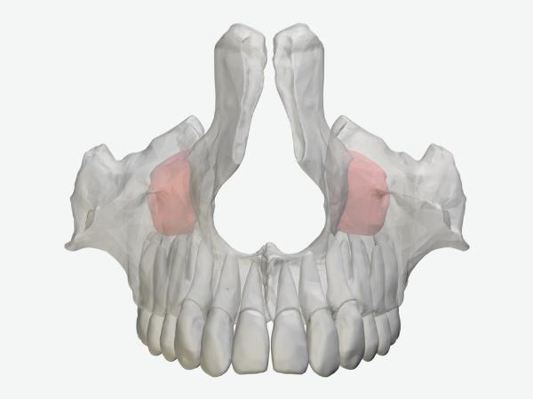 마곡역치과_2. 상악동 거상술 치조정 접근법, 언제 어떻게 진행될까? 관련 이미지 1