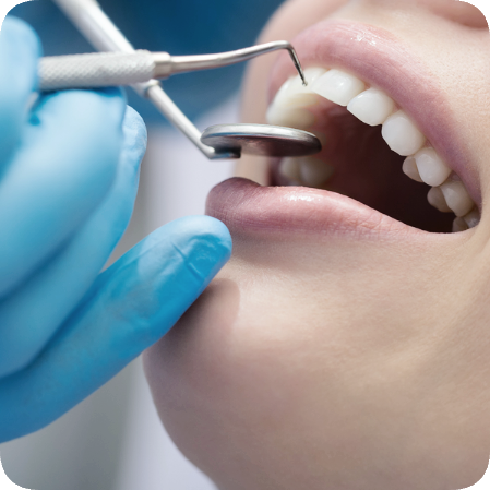 마곡역치과_&ldquo;치아가 개운해지는 6단계 여정&rdquo; [ 4.  에어플로우 스케일링 과정 ] 관련 이미지 7