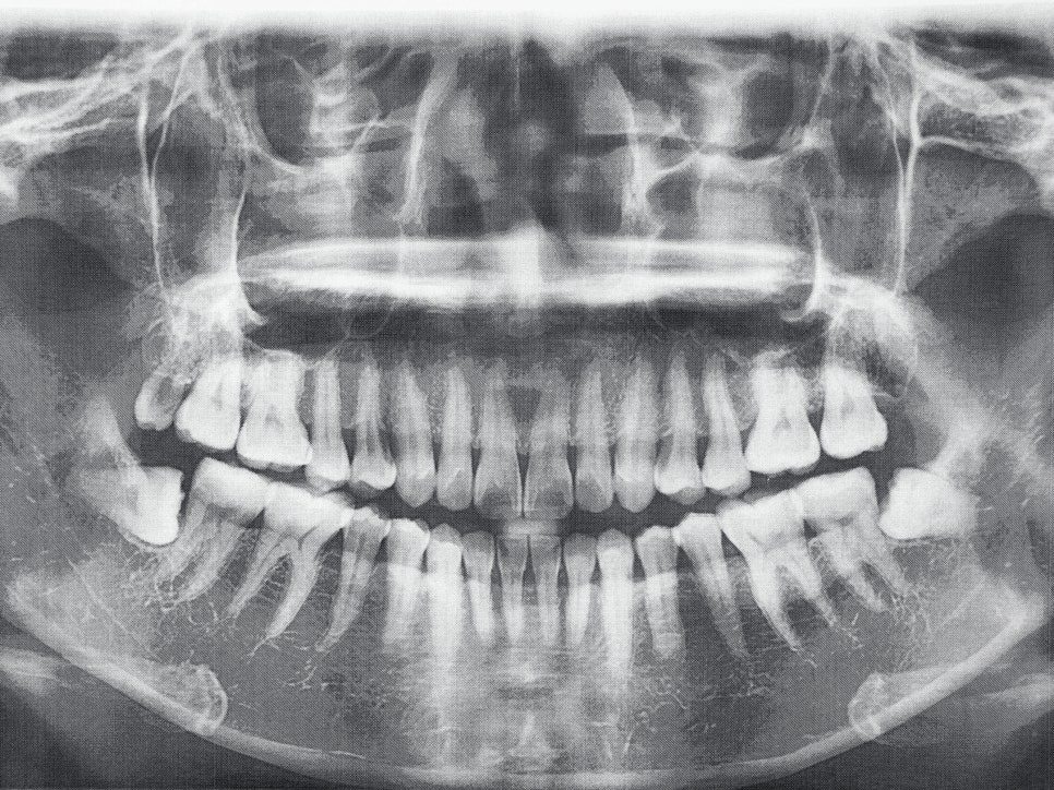 Magok-dong Dental Clinic_2. Why Are There So Many Types of Dental X-ray Radiation? A Clear Summary image 1
