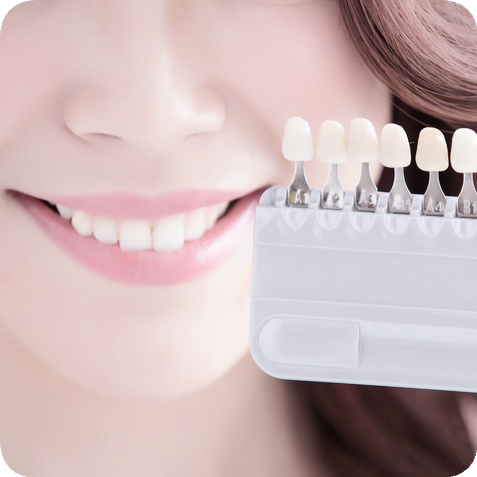 마곡동치과_전문가 미백 관련 이미지 2