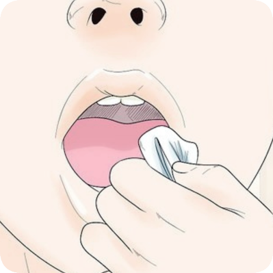 마곡치과_"내 치아를 오래 쓰는 가장 현명한 습관&rdquo; [ 5. 임플란트 수술 후 주의사항 ] 관련 이미지 1