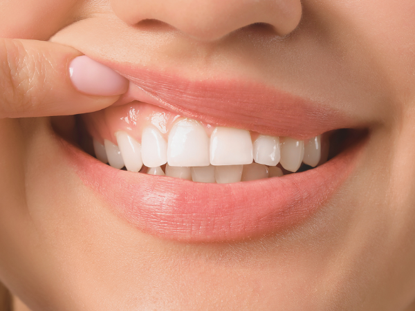 마곡동치과_1. 잇몸재생주사 PDRN, 연어주사 성분이 잇몸에 쓰이는 이유 관련 이미지 4