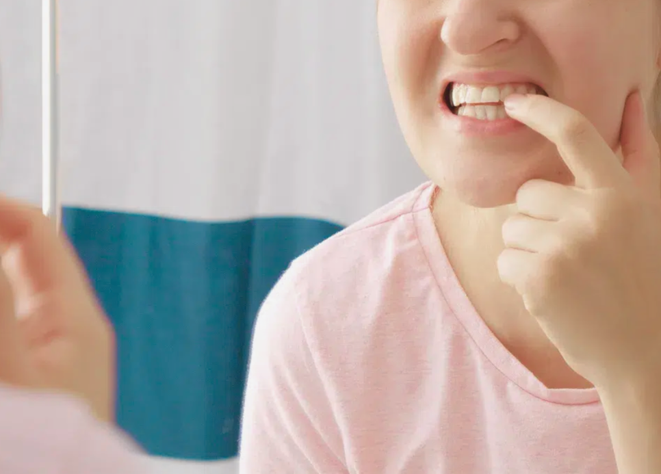 [마곡동치과_치아 흔들림 시리즈2] 흔들리는 이빨, 그냥 두면 어떻게 될까요? 관련 이미지 1