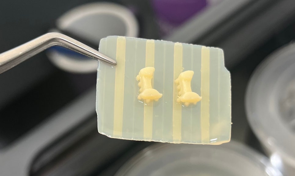 마곡동치과_당일 인레이 치료 과정 관련 이미지 8