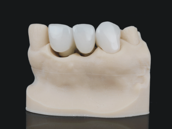 마곡동치과_ 부작용부터 유지법까지 한눈에! [ 5. 치아미백 궁금증 총정리 ] 관련 이미지 3