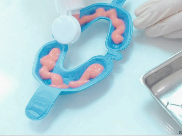 마곡역치과_&ldquo;불소도 다 똑같지 않아요!&rdquo;[2. 불소 종류와 상황별 선택법] 관련 이미지 5