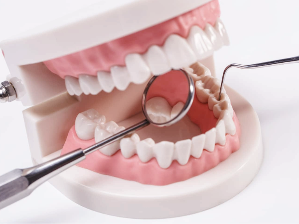 마곡동치과_&ldquo;내려가기 전에! 잇몸을 지키는 진짜 방법 7가지&rdquo;[5. 치은퇴축 예방법] 관련 이미지 6