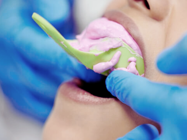 마곡역치과_3. 치아 보호를 위한 크라운 보철 치료 과정 관련 이미지 4