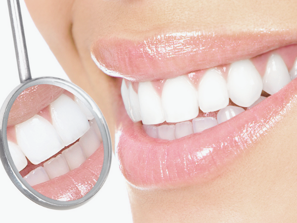 마곡동치과_ 1. 치석 제거는 기본! 스케일링 효과 5가지 총정리 관련 이미지 5