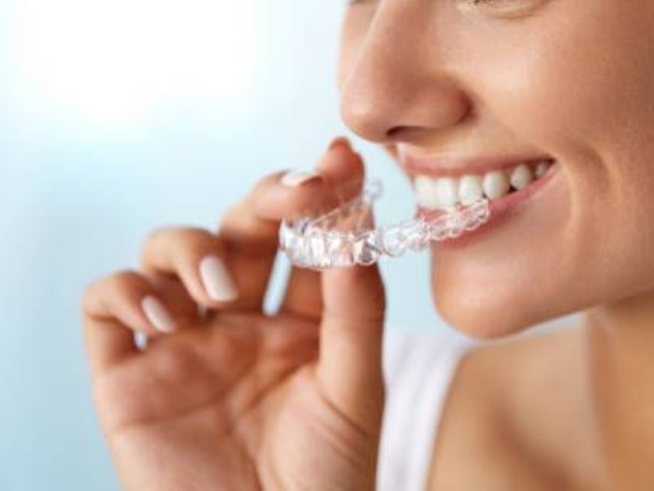 마곡역치과_ &ldquo;집에서 하얀 치아 만들기!&rdquo;[3. 생활치 자가미백 치료 특징과 과정 ] 관련 이미지 2