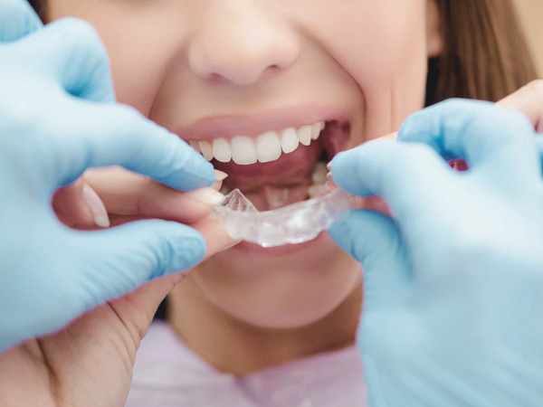 마곡치과_ 4. 이갈이 장치 유지 관리법 관련 이미지 5