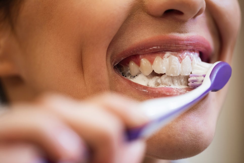 [ Magok Veneers_08 ] Post-Veneer Precautions: These Are the Things You Must Follow image 4