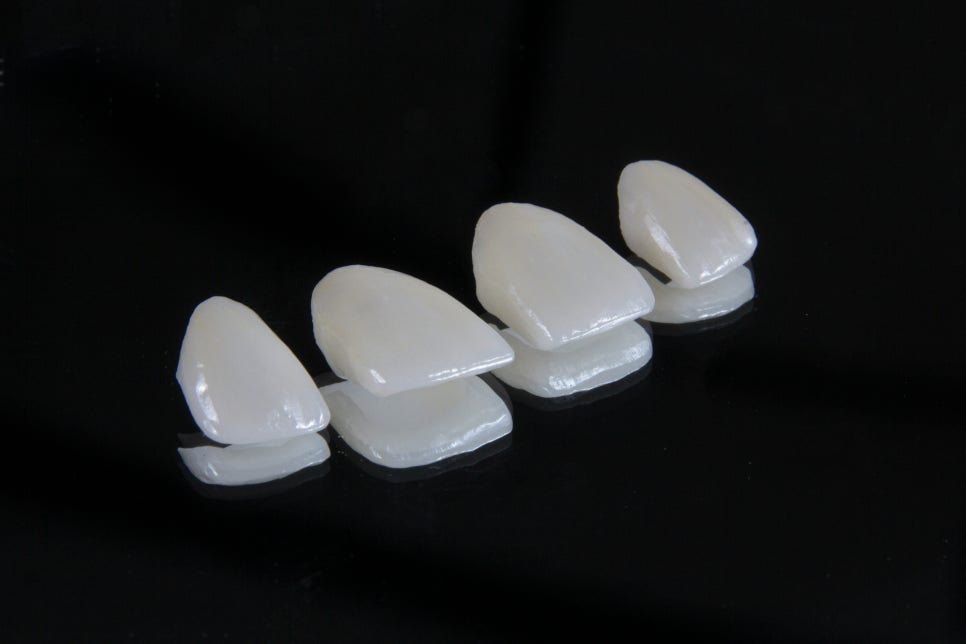 [ Magok Laminate_09 ] Laminate Veneers: These Misconceptions Are Common image 3