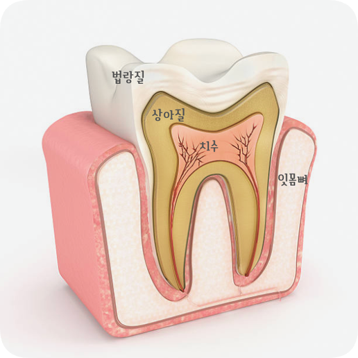 마곡동치과_ "자연치아 지키는 골든타임" [ 1. 신경치료 꼭 받아야 하는 5가지 경우 ] 관련 이미지 1
