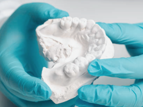 Magok-dong Dental Clinic_ “Taking Dental Impressions with Light!” [5. Digital Impression Taking with a 3D Intraoral Scanner] image 6