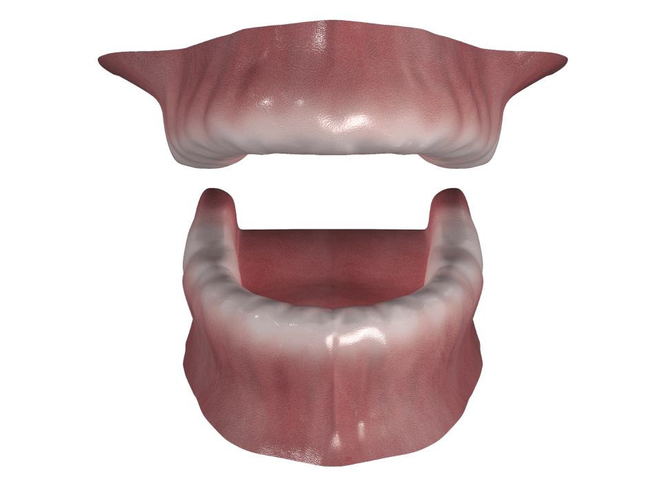 [ 마곡동치과_치아상실 5 ] 틀니, 실제로 써보면 어떤 느낌일까요? 관련 이미지 2