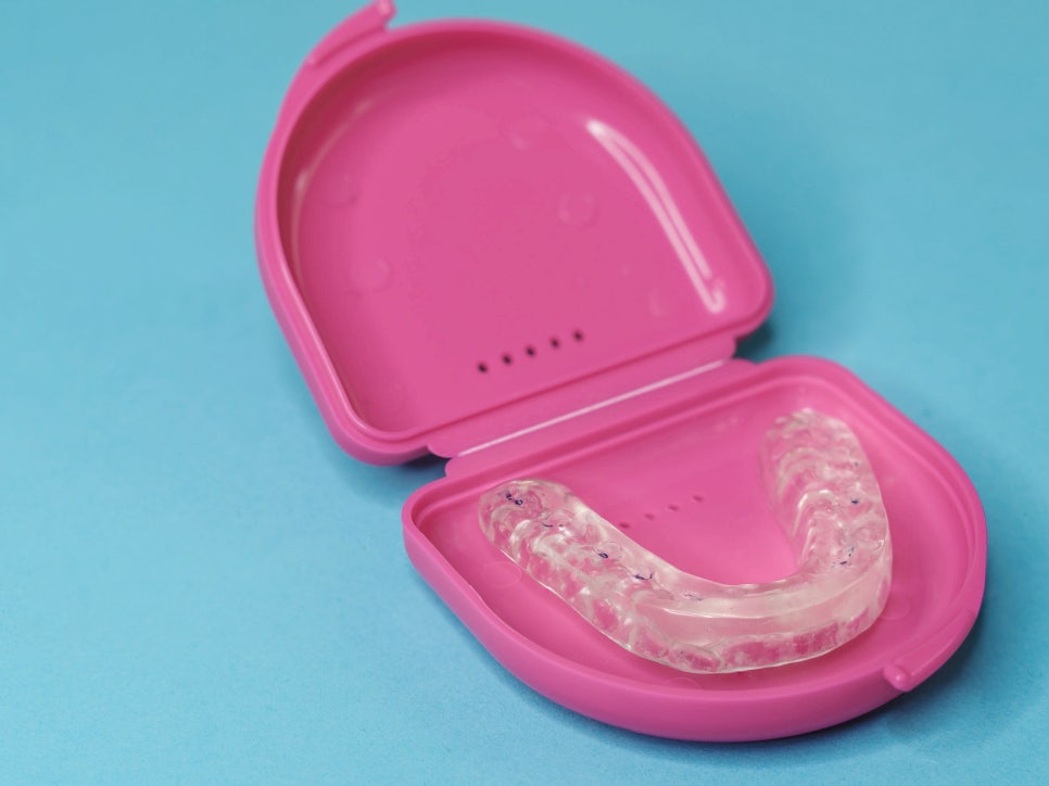 마곡치과_ 2. 이갈이 장치 사용 후기와 적응법 관련 이미지 5